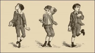 Comment est appelée la chorée de Sydenham dans le langage courant ?