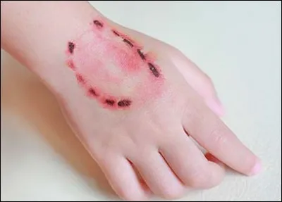 Le virus de la rage a disparu du territoire français.