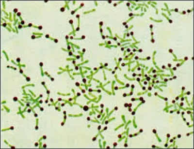 Quelle est la bactérie responsable de la diphtérie ?