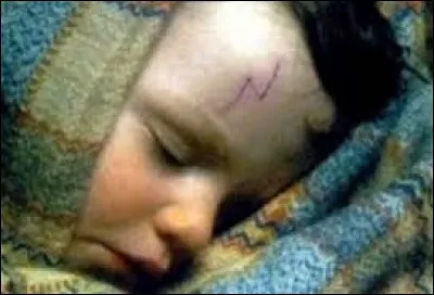 Comment Harry a-t-il eu une marque sur le front ?