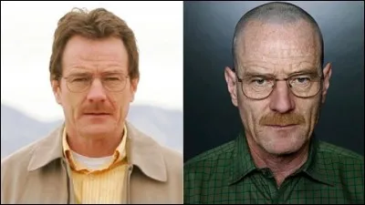 Pourquoi Walter White perd-il ses cheveux ?