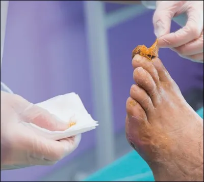 Merci pour l'information. Concernant les soins de beauté des pieds, j'avais une question basique pour vous, comment savoir que l'ongle est correctement coupé ?