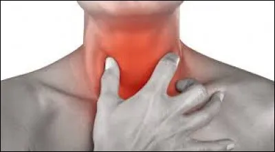 Quel médicament soigne les maux de gorge ?