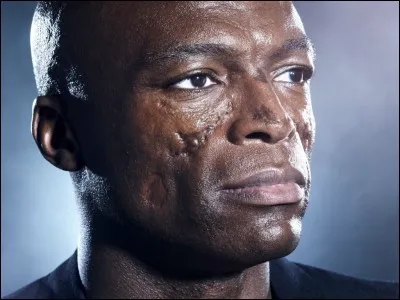 Pour terminer ce quiz, une question que nous nous sommes tous déjà posée.
Combien a-t-on de cils pour les paupières d'un il, environ ?