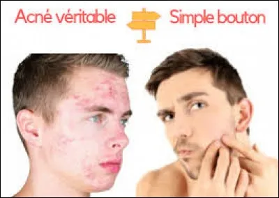 Le "Cochillus" est le nom donné aux boutons rouges enflammés.