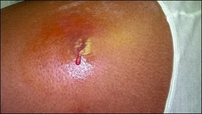 L'huile d'argan a des vertus cicatrisantes.