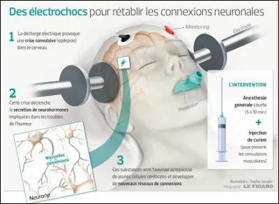 Dans les cas les plus extrêmes, on peut avoir recours à des interventions. Laquelle des trois ci-dessous ne consiste pas à envoyer des courants électriques dans le cerveau ?