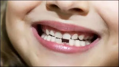 De combien de dents de lait se compose la mâchoire d'un enfant de six ans ?
