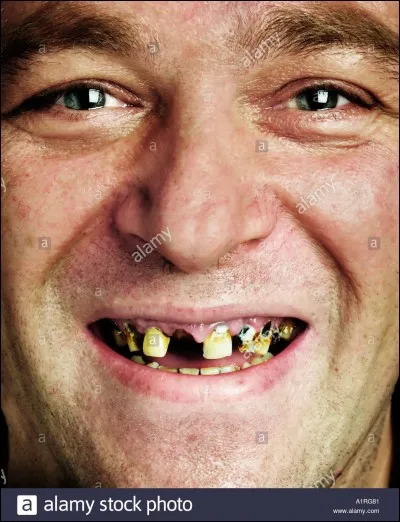 Et puis quoi encore ? Que je me BROSSE les dents ?