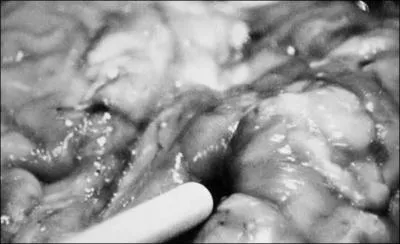 Que fait le cerveau quand on appuie dessus ?