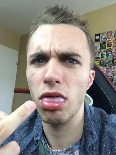 Squeezie aime-t-il ses abonnés ?