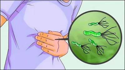 Quelle maladie du système digestif la bactérie Helicobacter pylori peut-elle causer ?