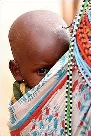 En France, l'esprance de vie des hommes  la naissance est de 75, 8 ans en moyenne alors qu'en Angola, elle est de 24 ans seulement.