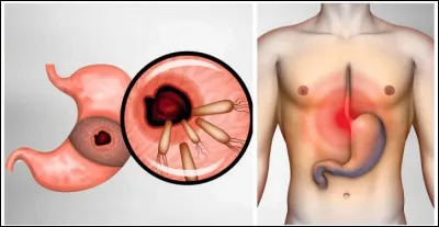 Qu'utilisaient les Grecs et les Romains pour calmer la toux et faire faire les douleurs d'estomac ?