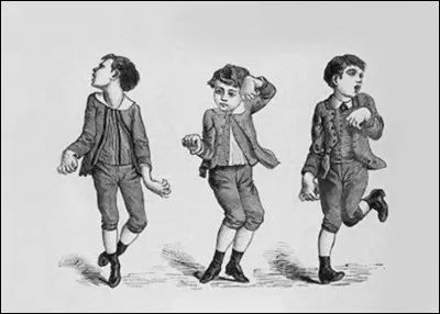 Quel est le nom plus courant de la chorée de Sydenham ?