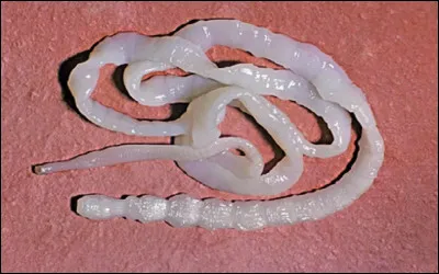 Quelle longueur peut atteindre un ver solitaire chez l'homme ?