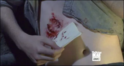 Un membre du groupe se fait mordre, que fais-tu ?