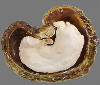 Quel est ce fruit tropical dont la coque contient une amande comestible qui après séchage et torréfaction acquière ses qualités gustatives ?