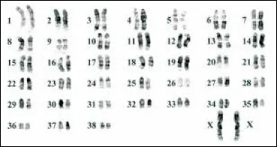Le caryotype présenté sur le document est celui...