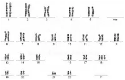 Observe le caryotype donné. Ce caryotype est :