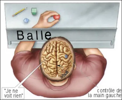 Quand parle-t-on d'un cerveau dédoublé ?