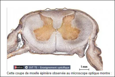 Que repr&eacute;sente cette coupe ?