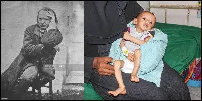 Voici une citation dun homme dont le père a été oublié lorsque les noms de ses collègues ont été inscrits sur un monument parisien majeur : 
« Pas d'injures à ces malheureuses que vous coudoyez le soir dans la rue. Souvenez-vous que la plupart ont été livrées à la prostitution par la faim et se sont laissées tomber dans le ruisseau pour ne pas se jeter à la rivière. »
Qui est ce personnage illustre ?