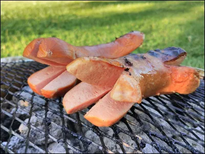 Chez l'homme, où se trouve le vermis ?