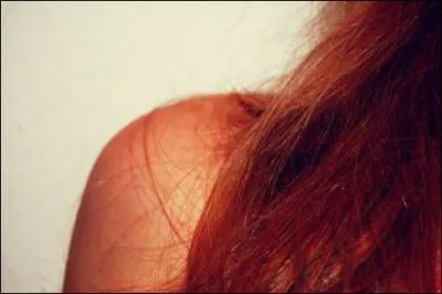 Une tude du dpartement gntique du Western General Hospital d'Edinburgh a trouv une nouvelle explication au nombre de roux en Ecosse ...