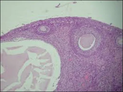 Arrivés à maturation, les follicules ovariens libèrent...