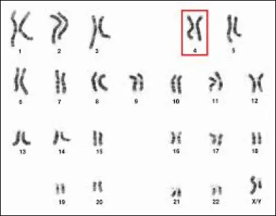 Quels chromosomes peuvent être touchés lors d'une trisomie ?