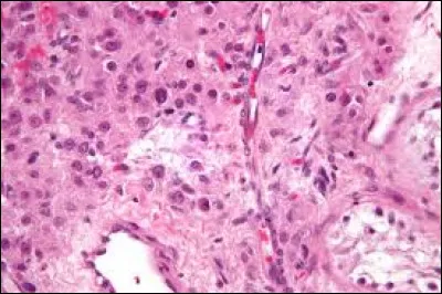 Quelles cellules secrètent la testostérone ?