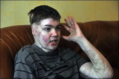 À quel âge Jonathan Destin a-t-il tenté de se suicider et comment ?