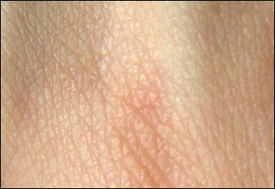 La peau est faite de trois couches, le derme, l'épiderme et l'hypoderme.