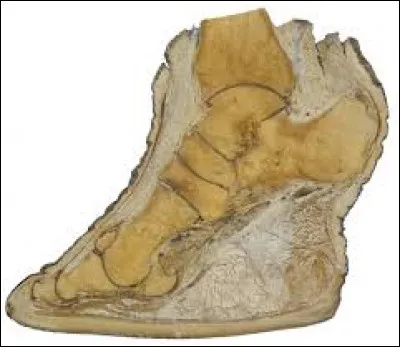 À qui appartient ce pied ?