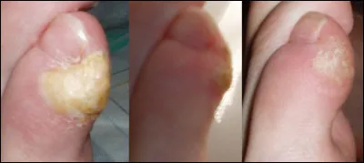 Un truc à la noix, c'est l'...