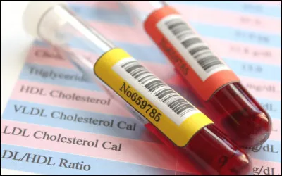 Quelle classe de médicaments, utilisés pour traiter l'hypercholestérolémie, a été découverte en 1973 par les Japonais Akira Endo et Masao Kuroda ?