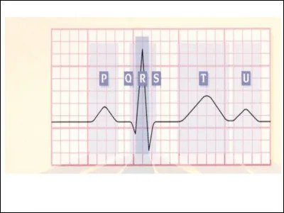 Dans un électrocardiogramme, que définissent les courbes ?