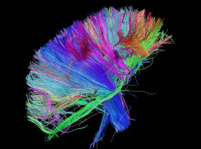 "The 2nd Law" est un des nombreux albums de...