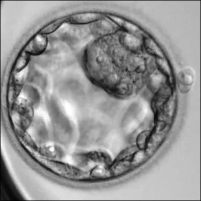 Quel organe éphémère du corps humain accueille le blastocyste ?