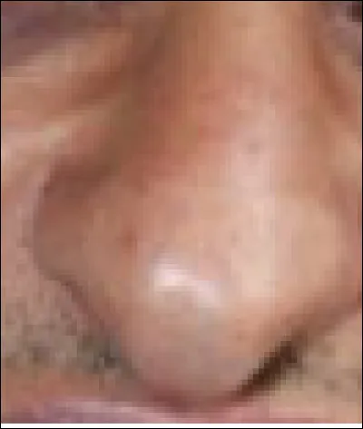 Ce nez appartient à un humoriste et acteur. Qui est-il ?