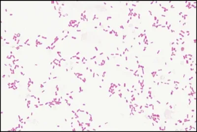 Cette bactérie, nommée Klebsiella, est l'agent responsable du rhinosclérome, une maladie rare qui affecte la cavité nasale. Elle apparaît en rose sur l'image d'un microscope après coloration de Gram. À quel type de bactéries appartient-elle donc ?
