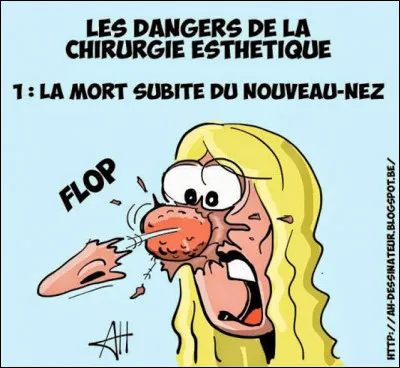 Parmi ces trois phrases, laquelle est correcte pour employer l'expression "passer sous le nez" ?