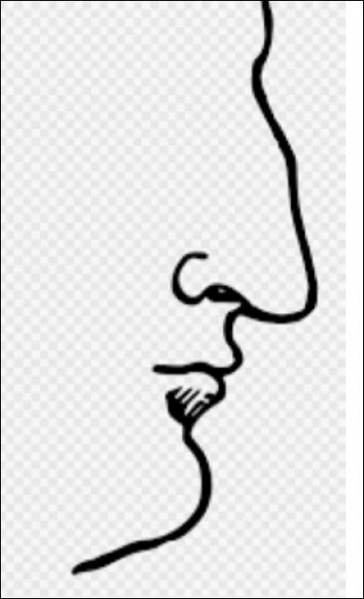 J'ai simplement une bosse sur mon arête. Je suis...