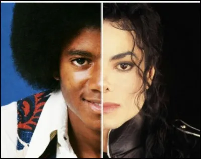 Après beaucoup trop d'opérations de rhinoplastie, qu'arriva-t-il au nez de Mickael Jackson ?