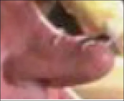 Quel personnage joué par Steve Martin a ce nez ? 
Ce personnage est amoureux du personnage de Daryl Hannah.