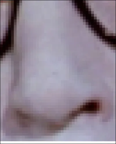 Quel personnage joué par Woody Allen a ce nez ? 
Dans ce film, son personnage va chez celui de Diane Keaton.