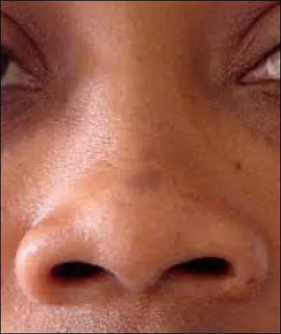 Complétez cette expression : "Tirer les ... du nez".