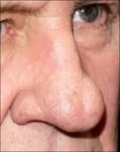 À quel homme ce nez appartient-il ?