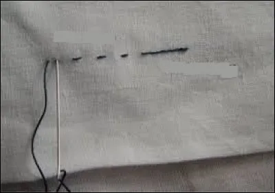 Où se trouve le point de piqûre ?